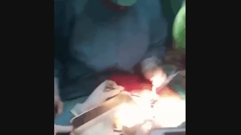 Что только не достают из желудка