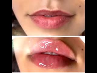 Dr antonina guz 20200715 103558 0 mp4