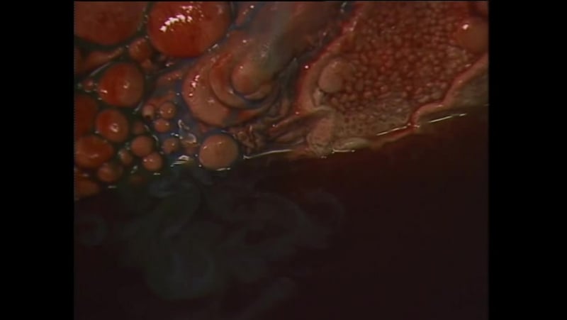 Русалка в канализации / ginî piggu manhôru no naka no ningyo (1988)