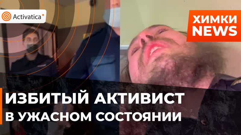 Избитому активисту вменяют “экстремистскую” статью