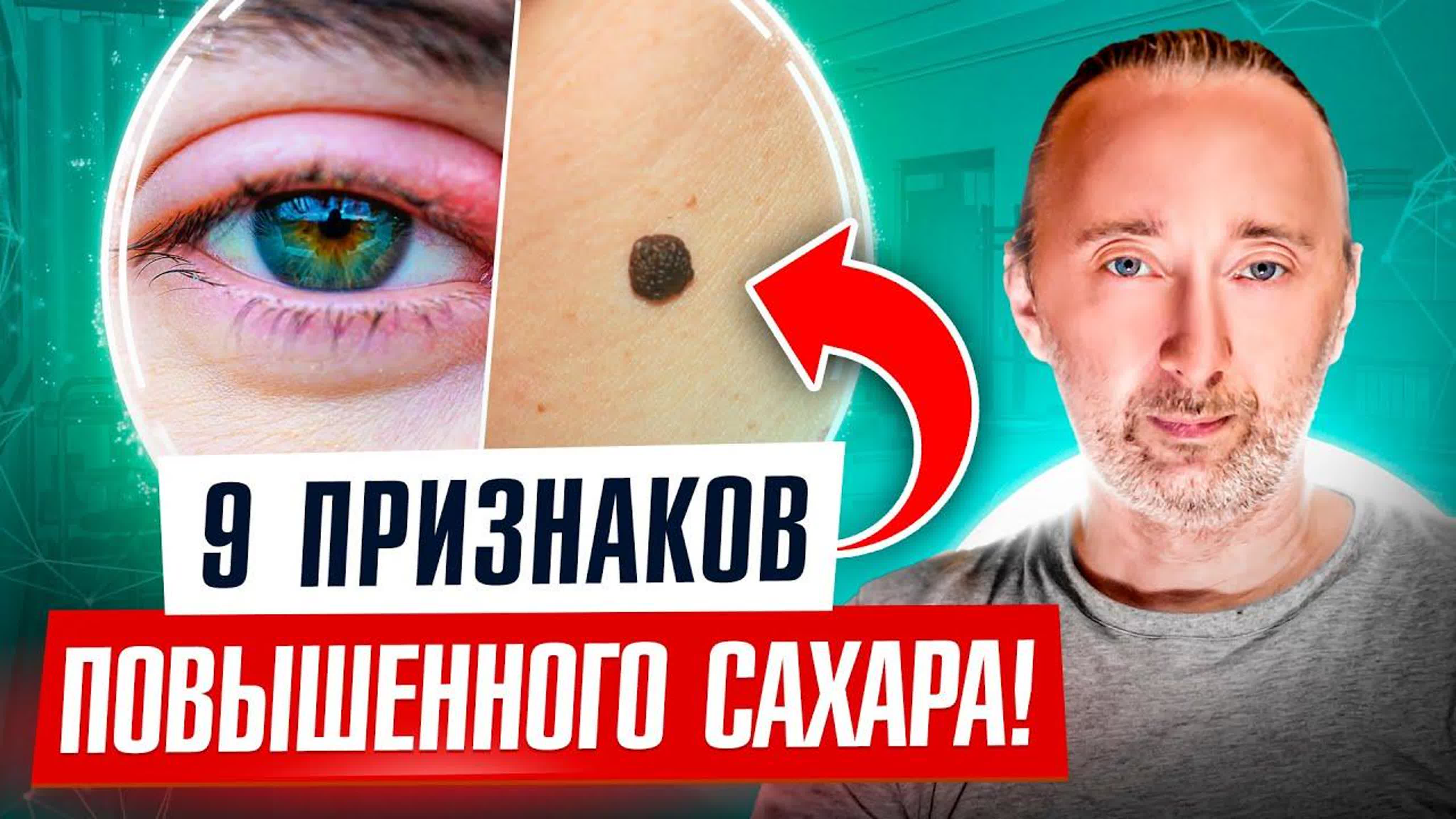 Ваша кожа явно говорит, что у вас повышен сахар, или уже есть сахарный  диабет 2 типа! вот 9 знаков! watch online