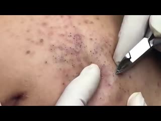 Множество мелких черных точек