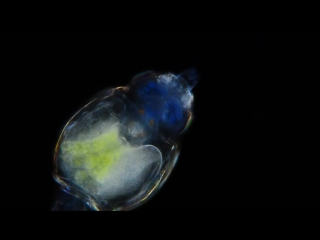 Amazing microscopic video! rotifer with nice corona 400x