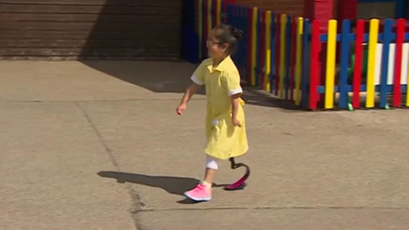 Как подруги девочки отреагировали на ее новый протез