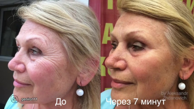 #instantly ageless мгновенная помощь при морщинах и мешках под глазами в чернигове