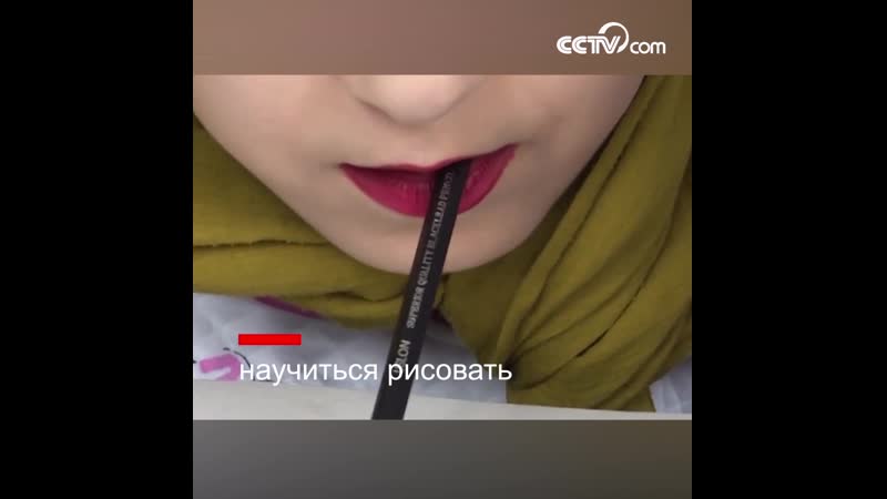 19 летняя девушка из афганистана не может свободно двигать конечностями