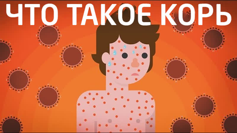 Что такое корь делать привиу или нет? | kurzgesagt на русском | kvashenov