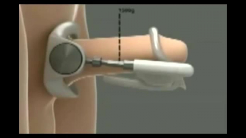 Экстендер pro extender увеличение члена