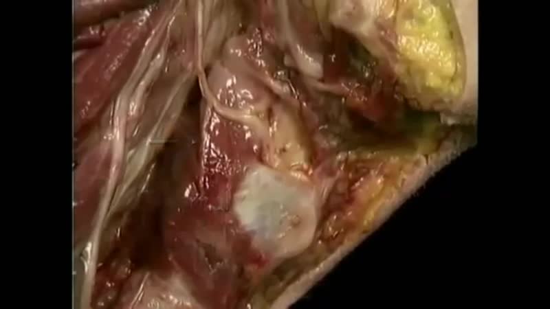 Атлас акланда часть 3 черепные нервы