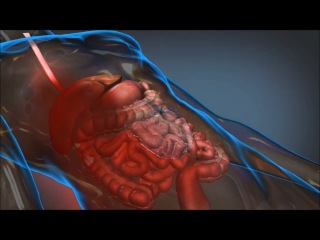 Darpa's wound stasis technology could save lives