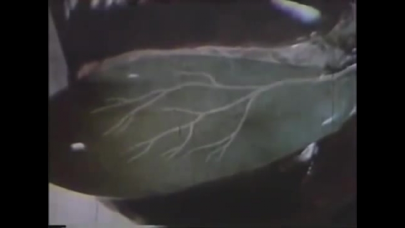 Топографическая анатомия желчного пузыря и желчных путей