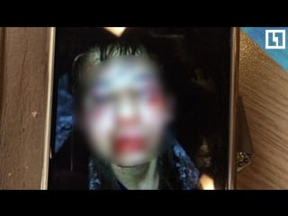 Молодые избили до полусмерти
