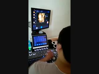 Dw c900（vet12)）fetal exam real time video