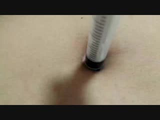 Needle navel