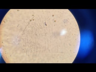 Dunaliella salina mps seconde 9 et seconde 10 micro algue appartenant au phytoplancton (1)