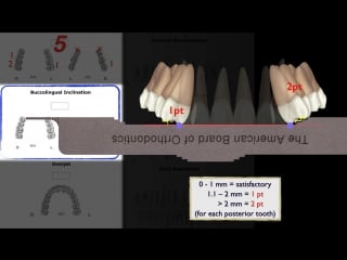 2017 abo cre cast radiograph evaluation by chris, angle lee part 2 ортодонтия