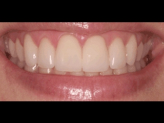 Orthodontic services