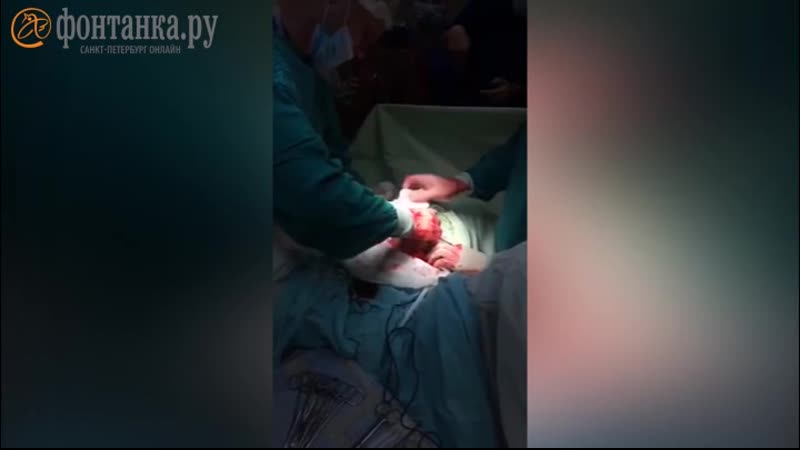 Извлечение гигантского фаллоимитатора из тела петербуржца