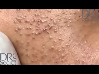 Множество угрей