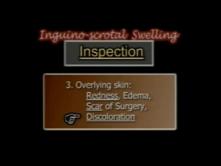 4 examination of inguinoscrotal swelling clinical examination