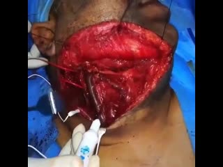 Проверка нервных окончаний