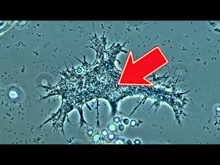 Жуткий микроорганизм найденный в городском пруду