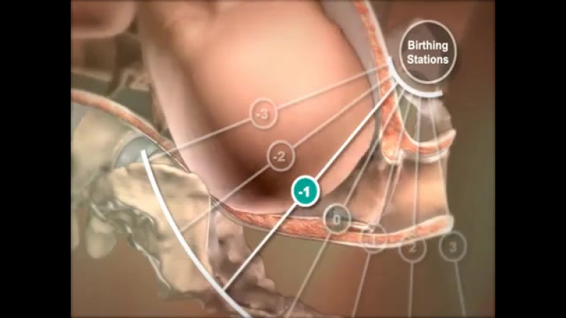 Биомеханизм родов в 3d(любовь фармацевта к врачу)