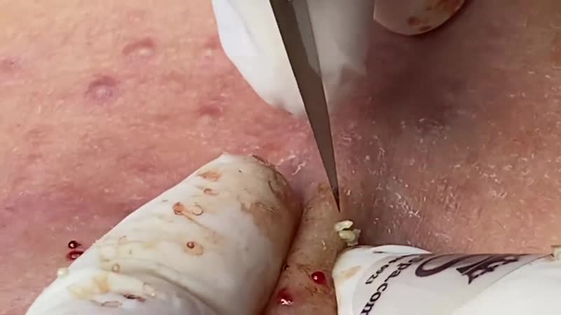 "тысяча выдавливаний", завершающий, 9 сезон, серия 1 из 4