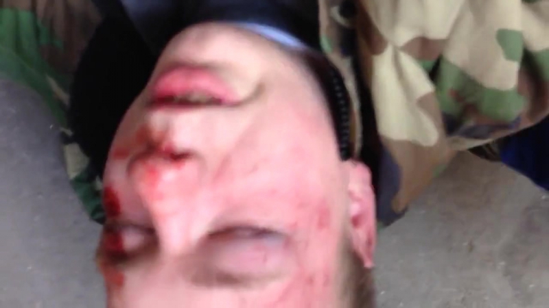 Антифа избивают бойца новороссии