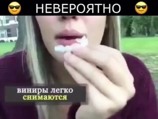 Perfect smile veneer