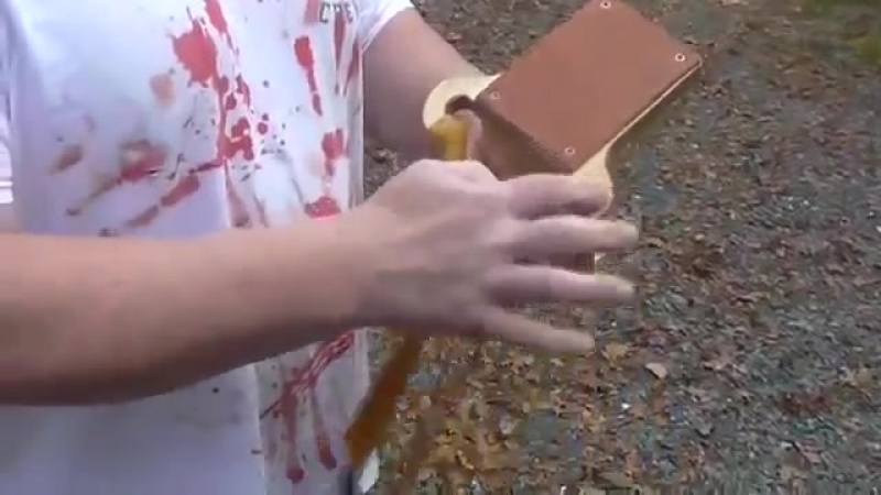 Пробил голову из рогатки, причем себе! смотреть с 1 20