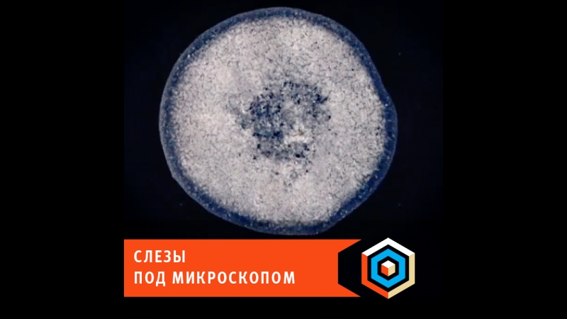 Слезы под микроскопом