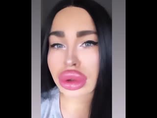 #lipsfiller #lipfiller #biglips #hugelips #siliconelips #пухлыегубы #силиконовыегыбы #большиегубы #филлер #filler #fillers #lips