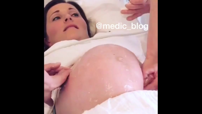 Акушерский поворот