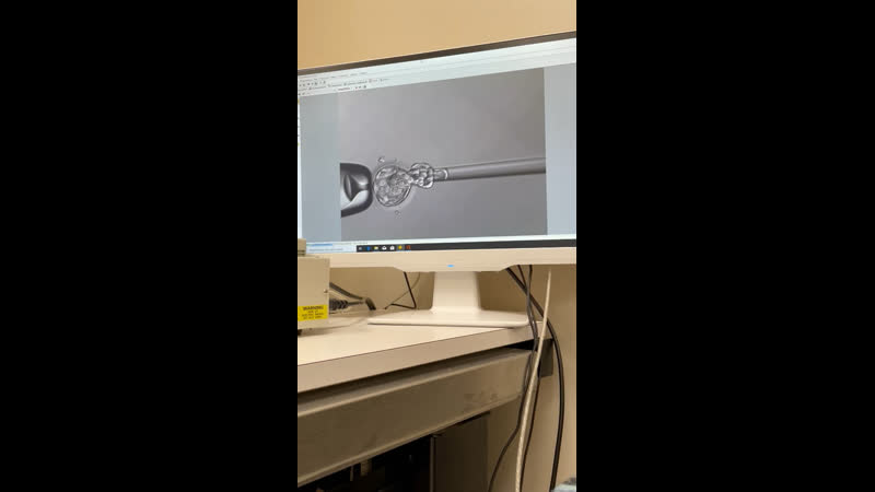 Биопсия эмбриона