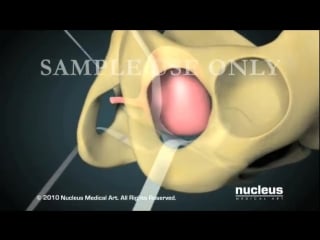 Nucleus obstetrics and gynecology demo (2010)