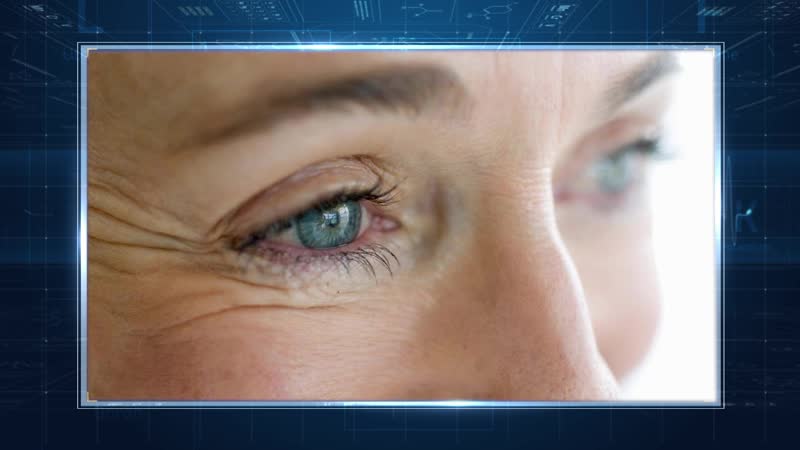 Блефаропластика век