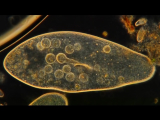 Amazing microscopic hd video! paramecium feeding!!