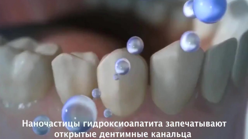 Seal porn video – Denta seal зубная паста с эффектом пломбирования