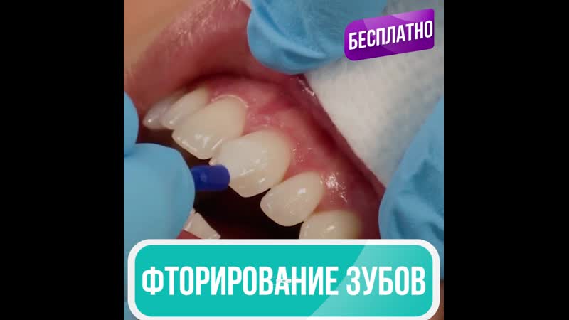 Консультация и диагностика + панорамный снимок + фторирование бесплатно!