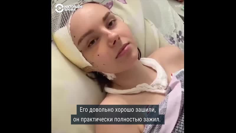Пострадавшая во время протестов в минске уже месяц в больнице
