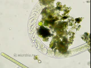 Беременная нематода, 400х