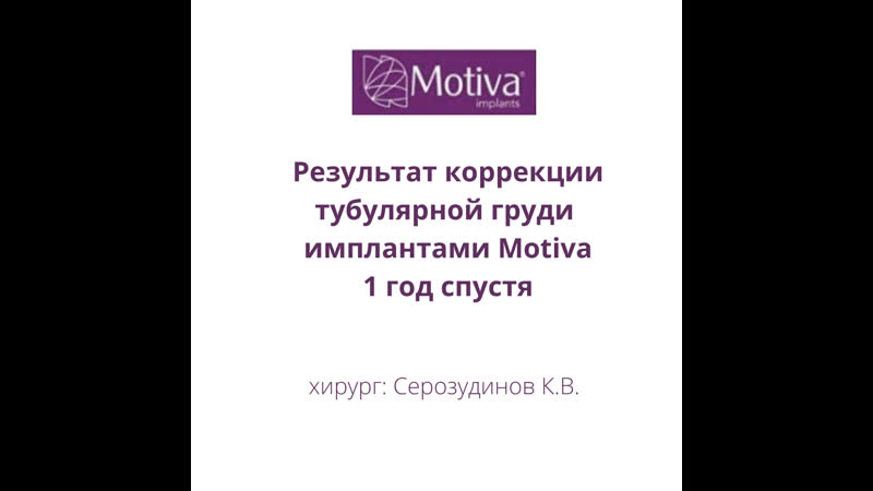 Коррекция тубулярной груди результат через год