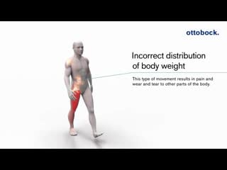 How the c brace® leg orthosis works ottobock