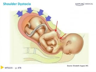 Ob gyn chapter 12 complications of labor and delivery