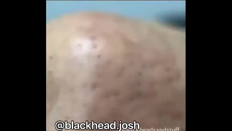 🤗 гадости для радости, от медик блог