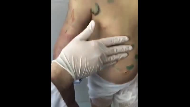 18 летняя аиша на осмотре