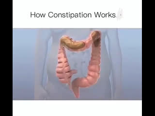 How constipation works