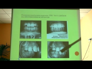 Ортодонтия лечит сколиоз и артроз анисимова н а