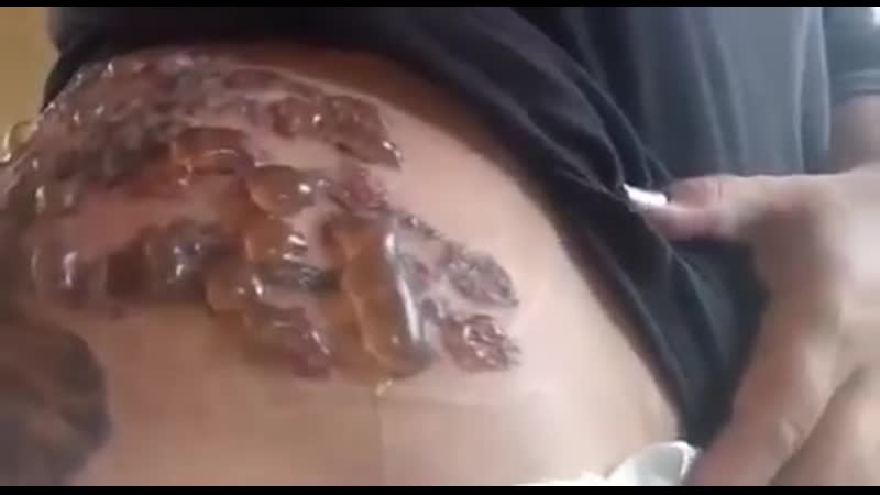 Медицина! кто знает, что за инфекция?